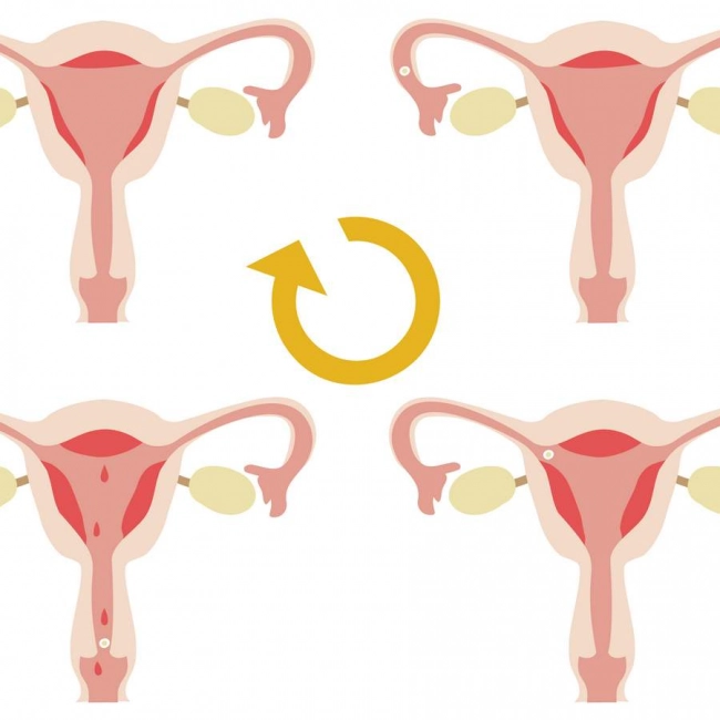 Cycles menstruels irréguliers Cycles menstruels irréguliers