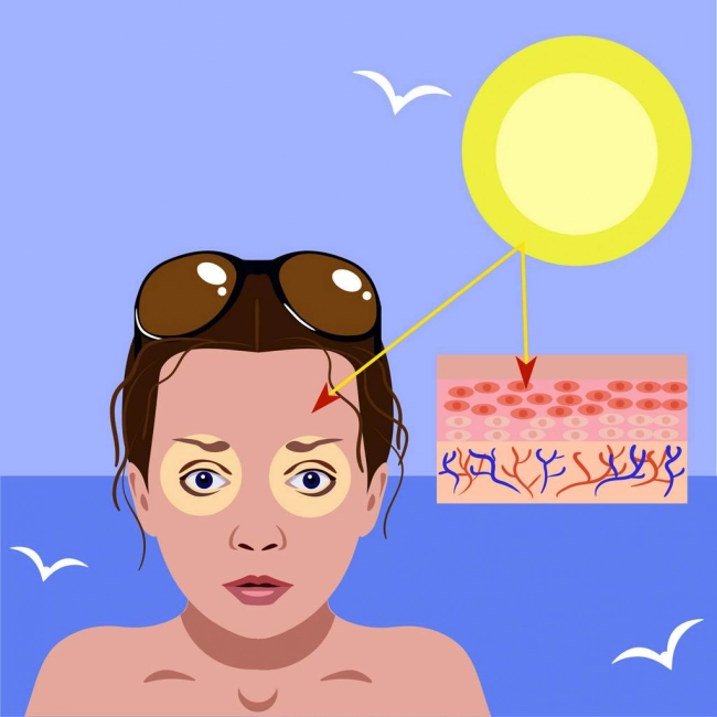 Coup de soleil au visage Coup de soleil au visage