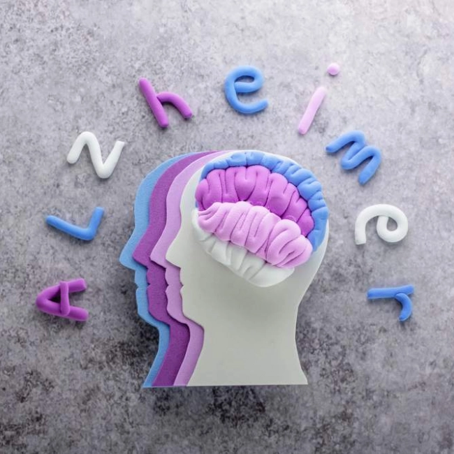 La maladie d’Alzheimer