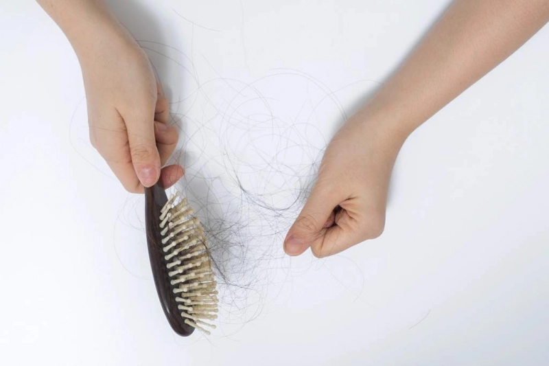 Quels bons comportements en cas de chute de cheveux ? - Compléments Alimentaires Marins Quels bons comportements en cas de chute de cheveux ?